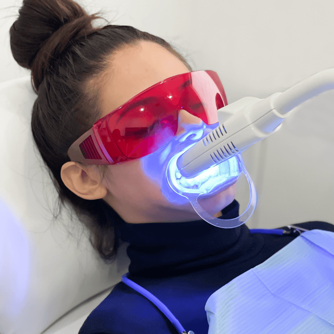 Client getting teeth whitening