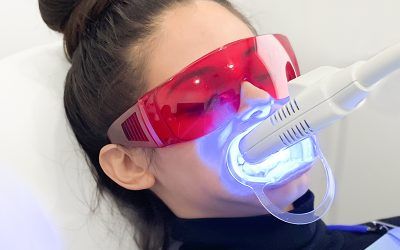 You Can Now Take an Online Cosmetic Teeth Whitening Course Anywhere in Canada
