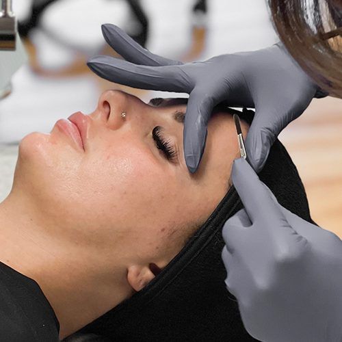 Gloved hands holding dermaplaning blade against female client's forehead.