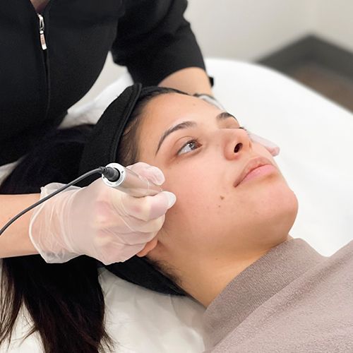 Hand covered by transparent glove holding microneedling pen device on female brunette client's cheekbone.
