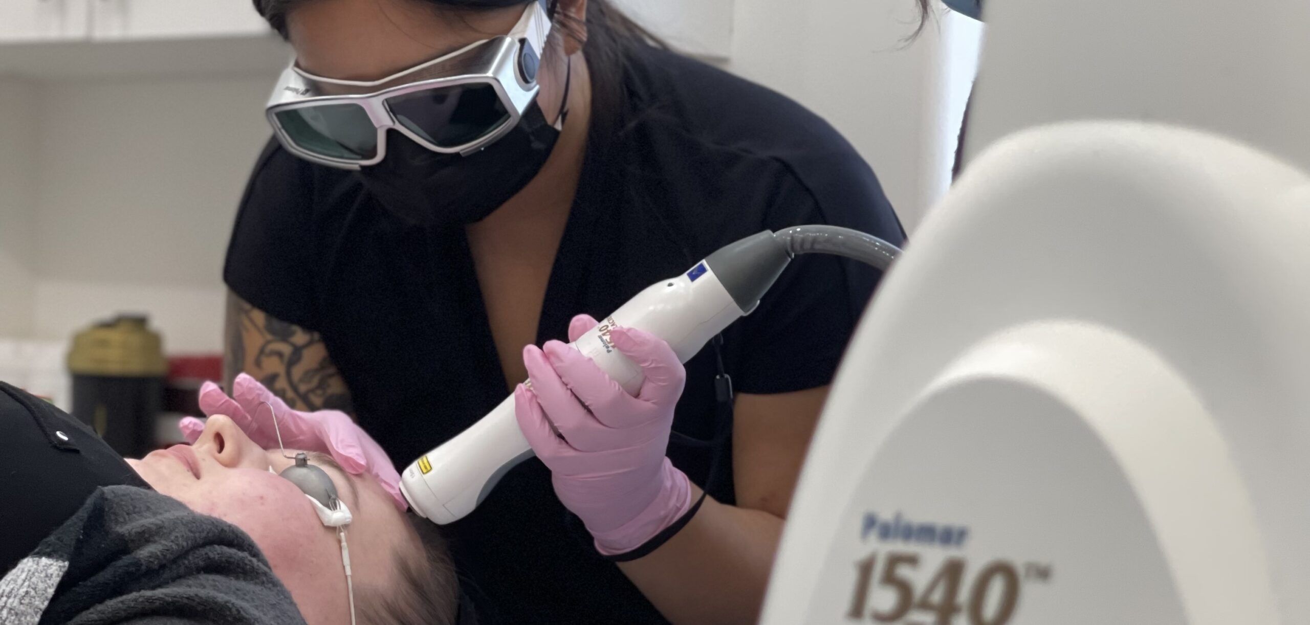 Laser scar removal on model