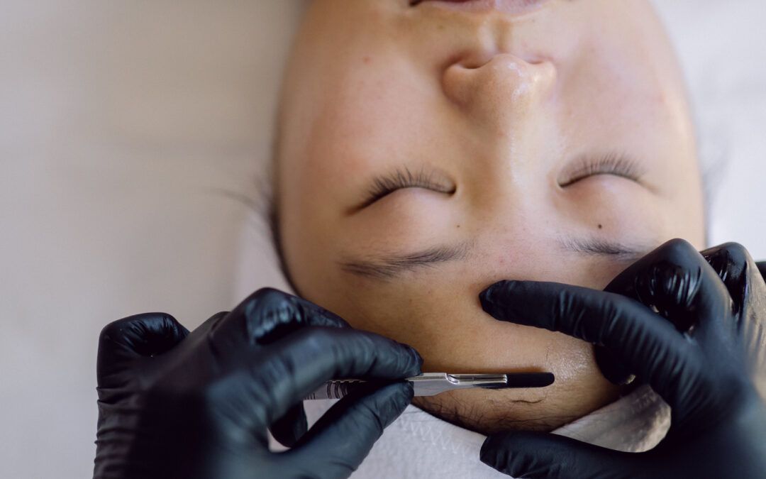 Dermaplaning service on model