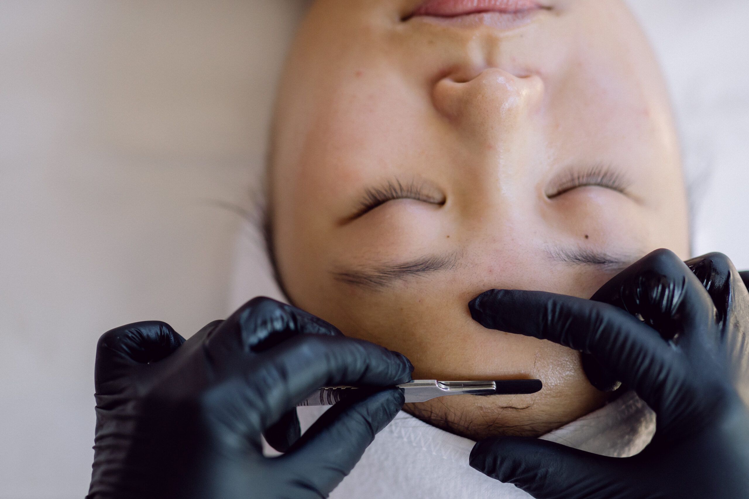 Dermaplaning service on model