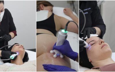 Medical Esthetics: How does radiofrequency (RF) work?