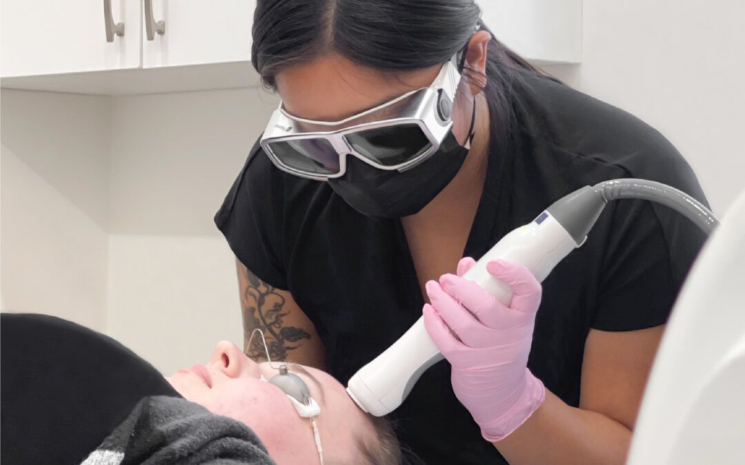 Student performing laser treatment on client's forehead. laser skin transformation