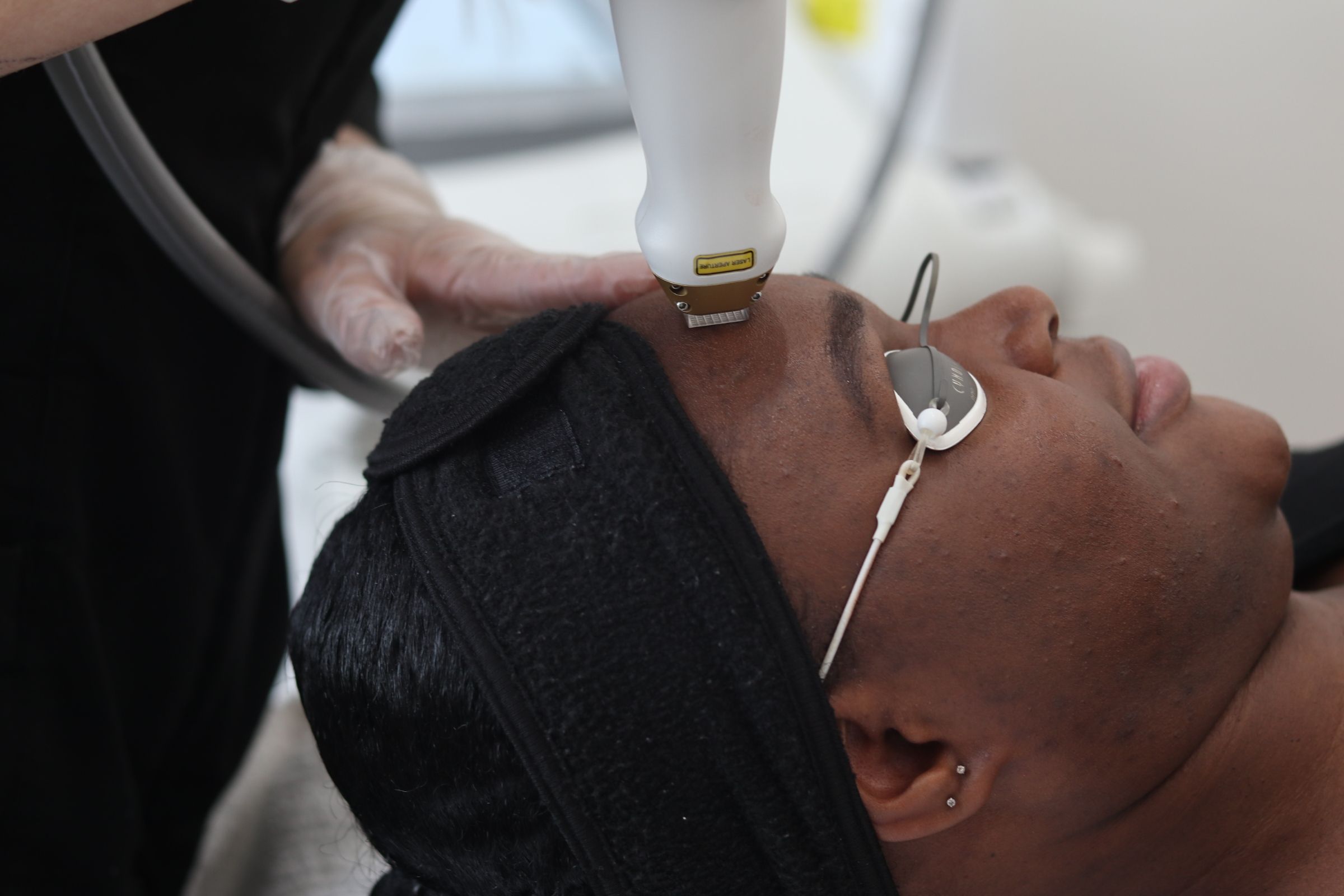 laser technician treating a guest