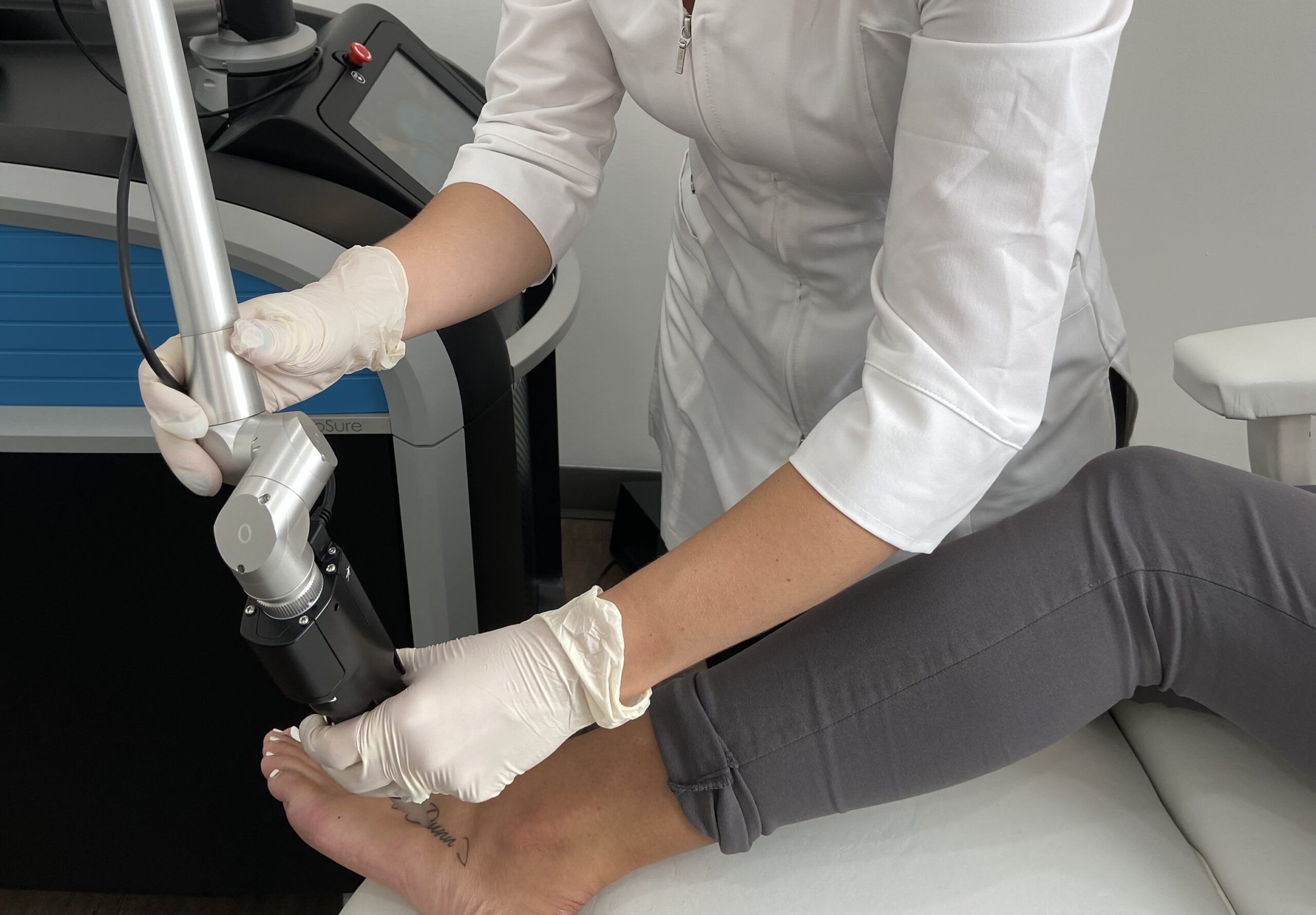 laser tattoo removal on a foot