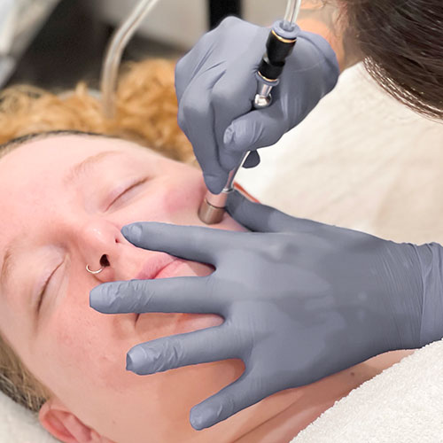 A student practicing during a microdermabrasion course in Winnipeg