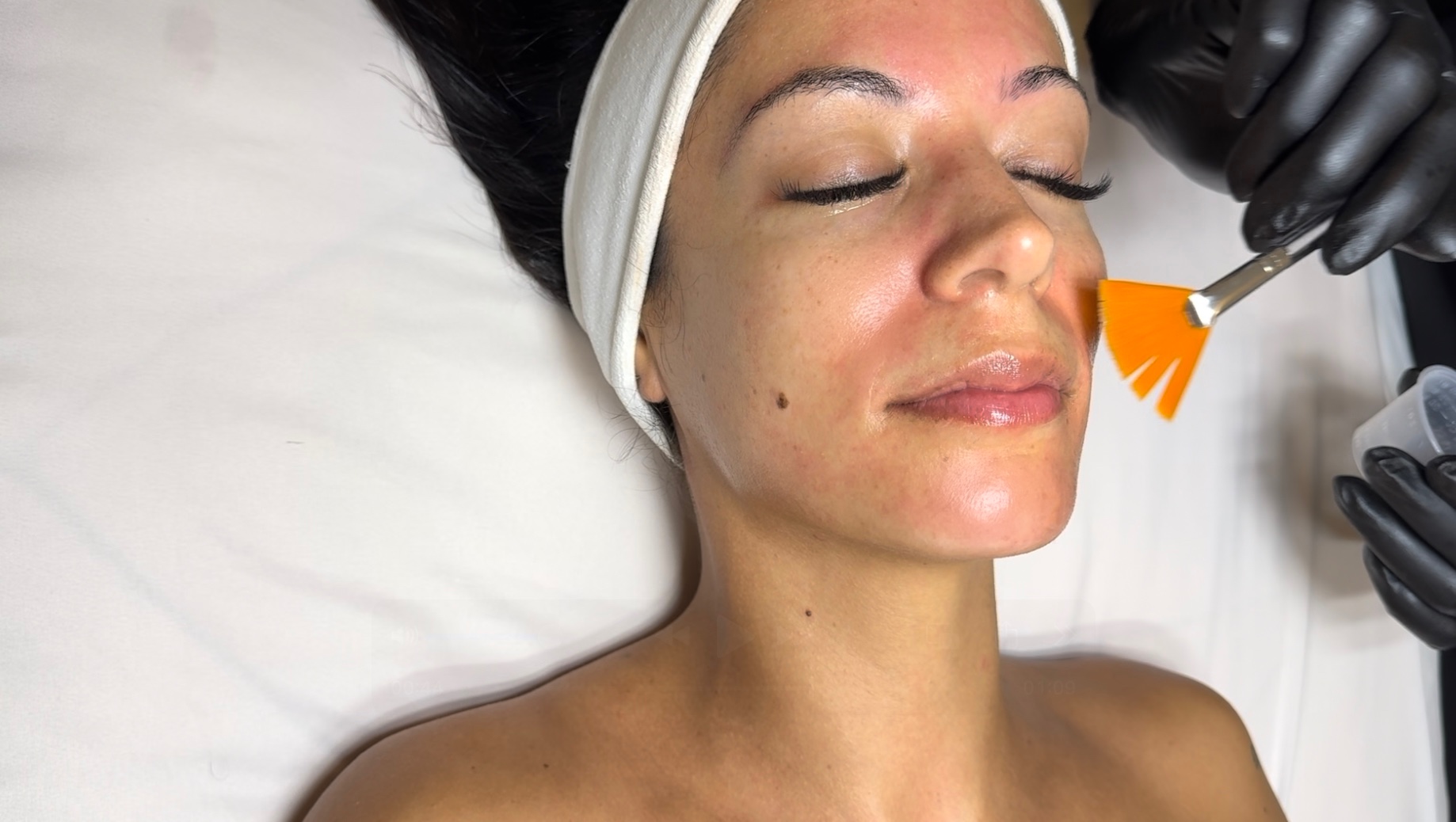 a client getting chemical applied on her face during a chemical peel course in winnipeg