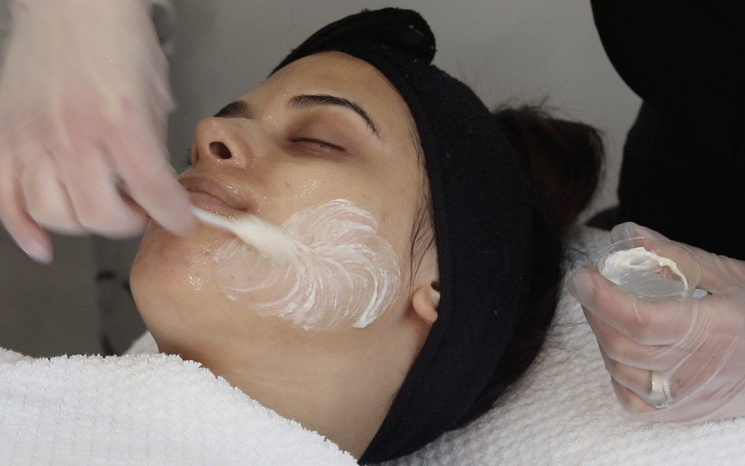 chemical application during a chemical peel course in winnipeg