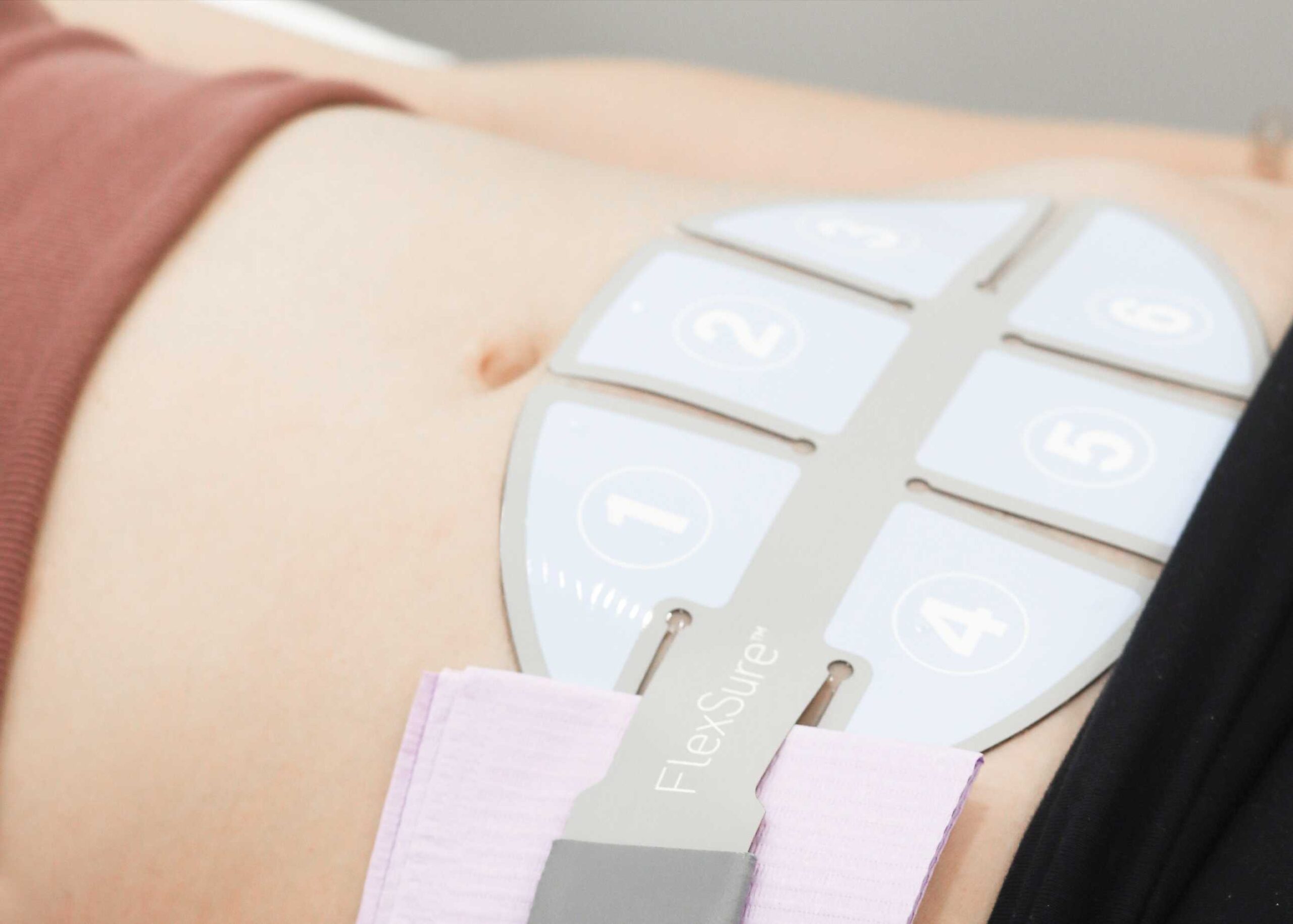 FlexSure body contouring treatment on the stomach at Wrapture Beauty Academy, non-invasive fat reduction using radiofrequency technology.